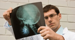 Brain Injury Lawyer - People Development Magazine