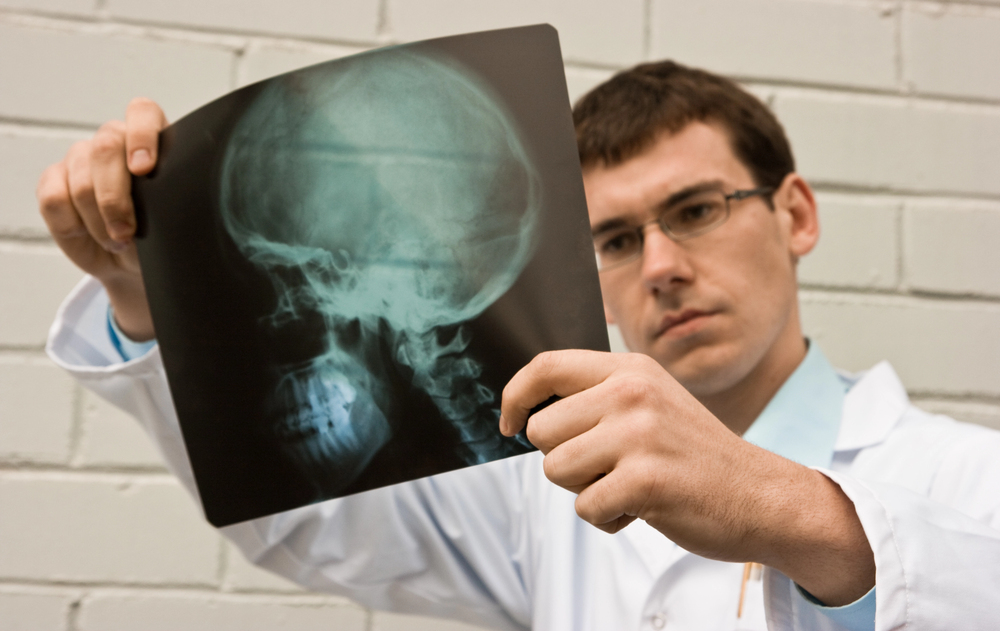 Brain Injury Lawyer - People Development Magazine Brain Injury Lawyer - People Development Magazine